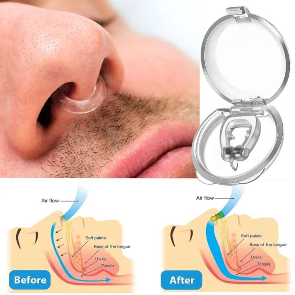 Anti-snoring magnet clip