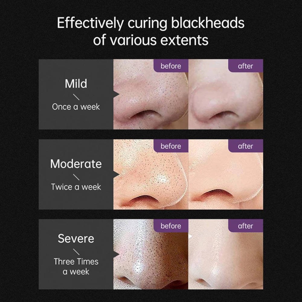 Black, cleansing face mask